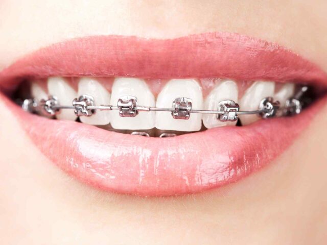 https://focusdentalclinic.ro/wp-content/uploads/2020/01/post_05-640x480.jpg