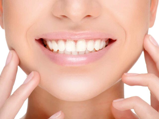 https://focusdentalclinic.ro/wp-content/uploads/2020/01/post_08-640x480.jpg