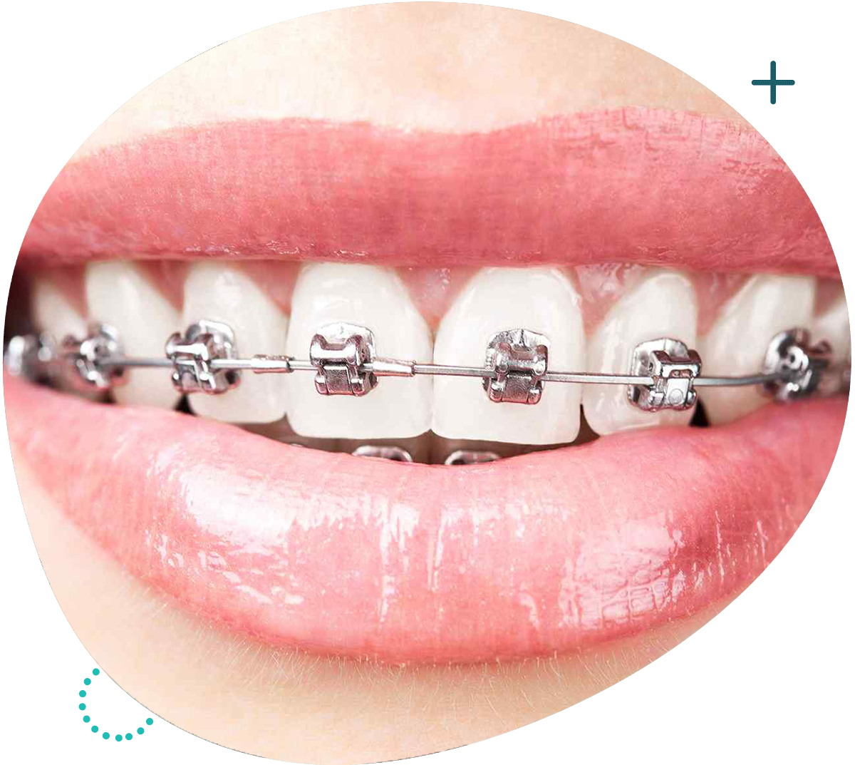 https://focusdentalclinic.ro/wp-content/uploads/2023/07/orto.png